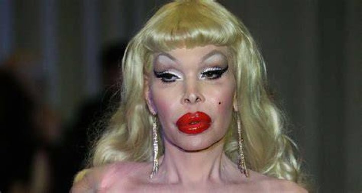 Amanda Lepore's Net Worth Disclosed
