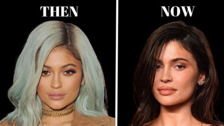 At What Age Did Kylie Get Surgery? Unpacking the Public Timeline