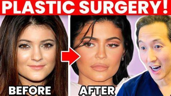 Before And After Surgery Transformation