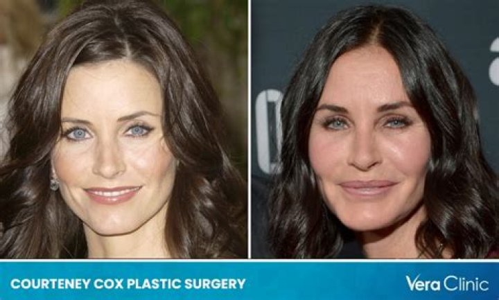 Courteney Cox's Plastic Surgery Regrets: A Cautionary Tale
