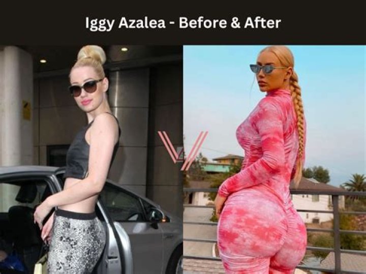Did Jadeteen Get a BBL? Unpacking the Buzz Around Her Body Transformation
