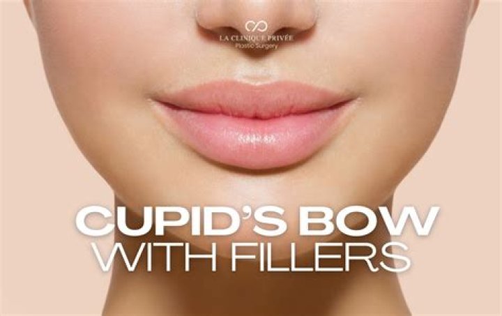 Discoveries and Insights about Lips with No Cupid's Bow