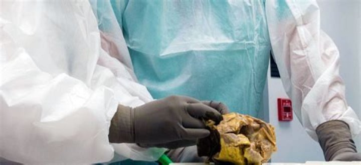 Discoveries From Tarrare Autopsy Images