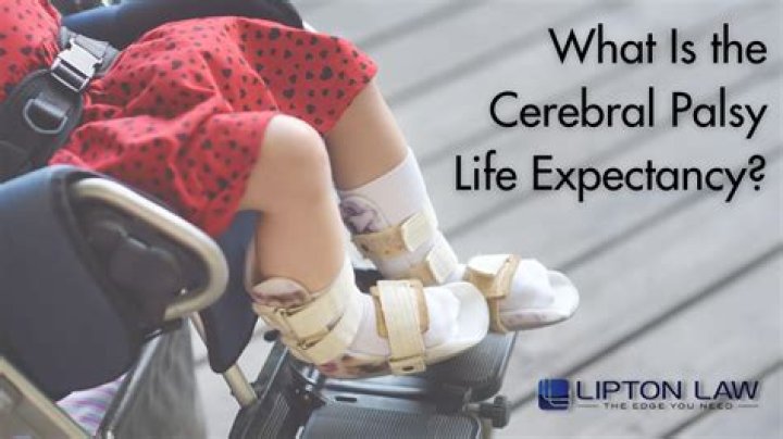 Does Katie Holmes Have Cerebral Palsy? Addressing Public Questions and Facts