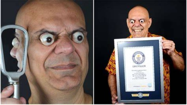 Explore The Enigma Of The World's Biggest Forehead