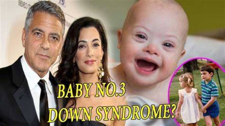 Exploring George Clooney's Twins And Down Syndrome Rumors