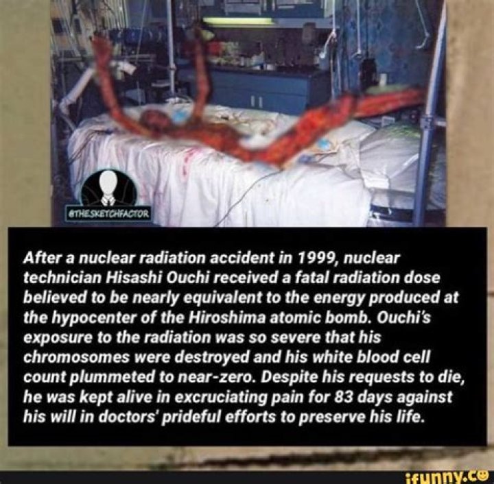Exploring the Real Photos of Hisashi Ouchi: A Unique Perspective on a Nuclear Tragedy