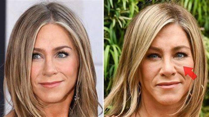 Has Jennifer Aniston had Plastic Surgery? Check Her Age, Bio, and More