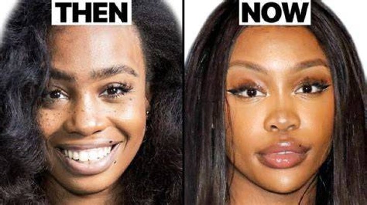 Has Sza Had Plastic Surgery? Fans Weigh In