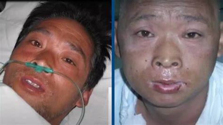 Hisashi Ouchi Autopsy Unveils Devastating Findings