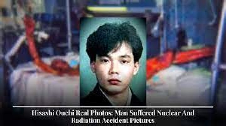 Hisashi Ouchi Full Photo: The Tragic Story Behind the Iconic Image