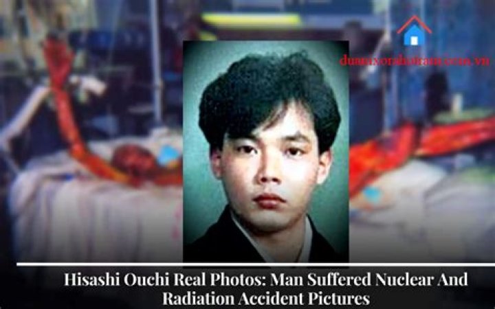 Hisashi Ouchi Photos Real: Unveiling the Truth Behind the Infamous Incident