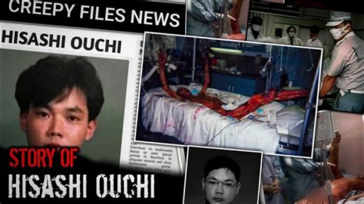 Hisashi Ouchi: The Real Story Behind the Tragic Incident and Unseen Photos