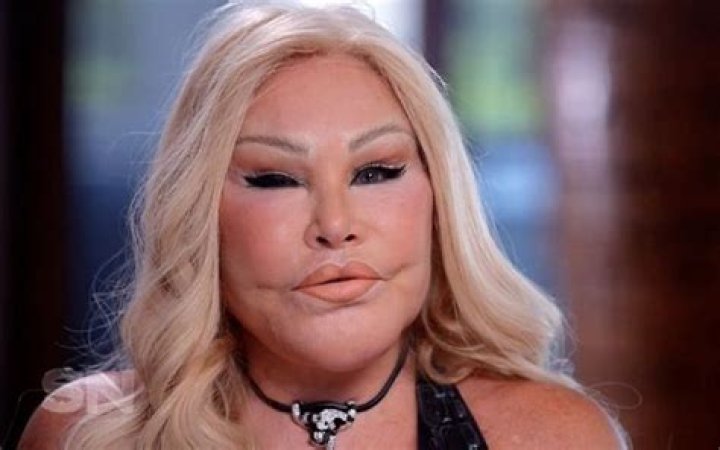 Jocelyn Wildenstein Biography | PulseBlog