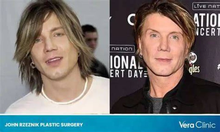 Johnny Rzeznik Plastic Surgery, Did Goo Goo Dolls Lead Singer John Rzeznik Had Plastic Surgery? |