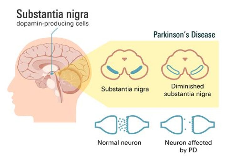 Julian McMahon and His Battle with Parkinson's Disease: A Comprehensive Insight