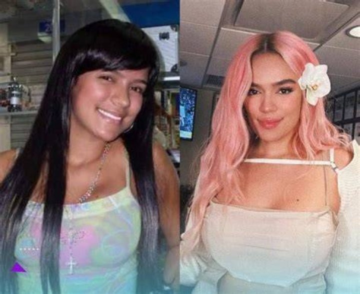 Karol G Before And After