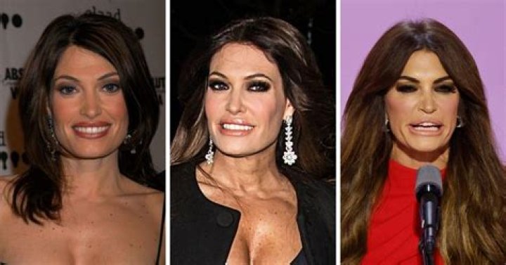 Kimberly Guilfoyle Before and After: A Comprehensive Look at Her Transformation