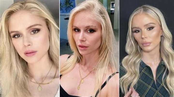 "lacey Wildd Qqq Plastic Surgery Before And" Unveiled