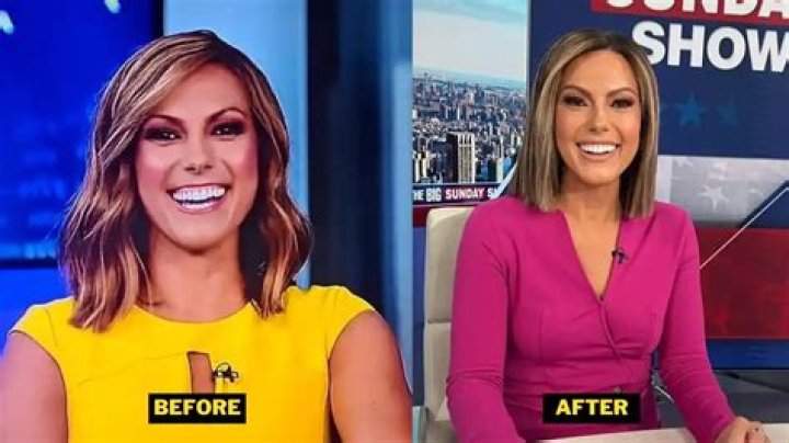 Lisa Boothe Teeth: A Closer Look at Her Radiant Smile and the Buzz