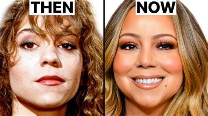 Mariah Carey's Plastic Surgery Journey: Nose Job And Beyond