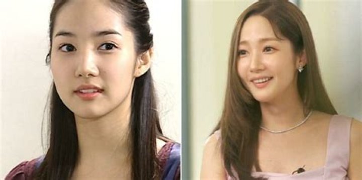 Park Min Young's Candid Journey With Plastic Surgery