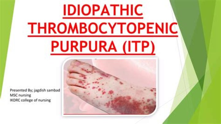 Uncovering The Truth About Idiopathic Thrombocytopenic Purpura