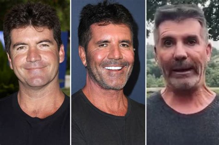 Understanding Simon Cowell's Son's Illness: A Deep Dive into the Challenges and Triumphs