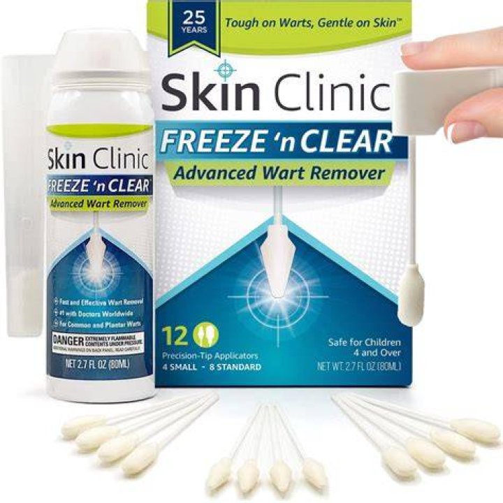 Unlock The Secrets Of Seborrheic Keratosis Removal At Home