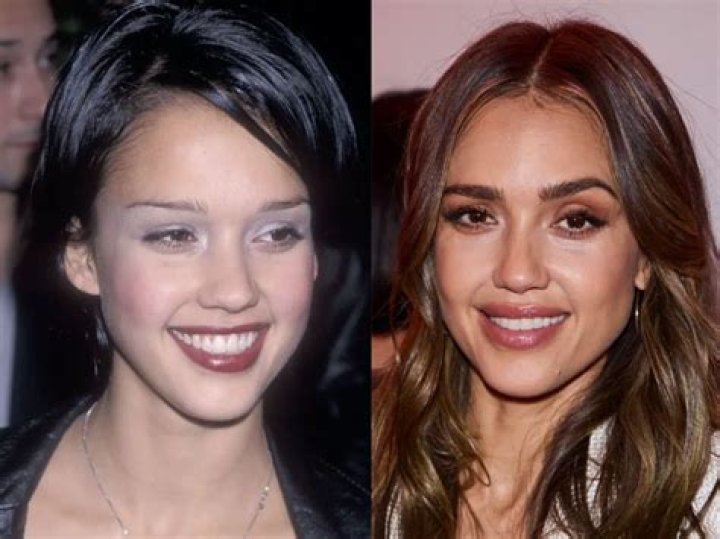 Unraveling Jessica Alba's Cosmetic Surgery Journey: Discoveries And Insights