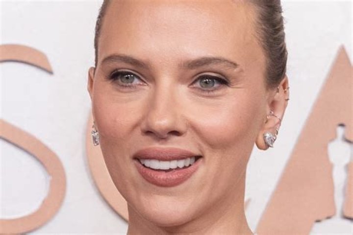 Unveiling Scarlett Johansson's Plastic Surgery Journey: Truth Or Speculation?