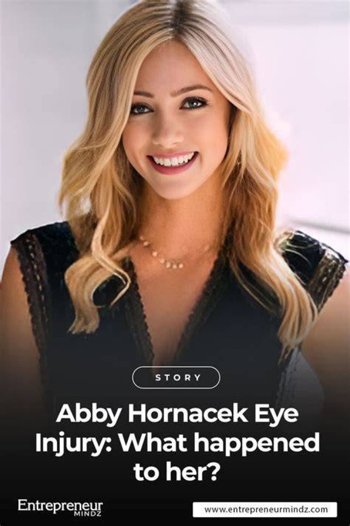Unveiling The Enigmatic Beauty Of Abby Hornacek's Eyes