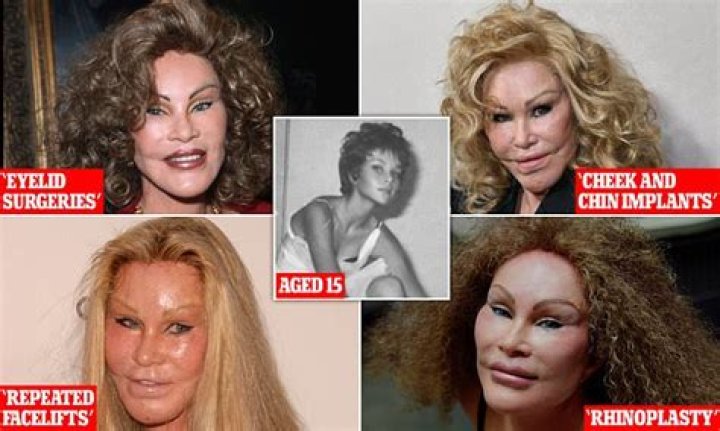 Unveiling The Enigmatic World Of Jocelyn Wildenstein: Beauty, Identity, And Transformation