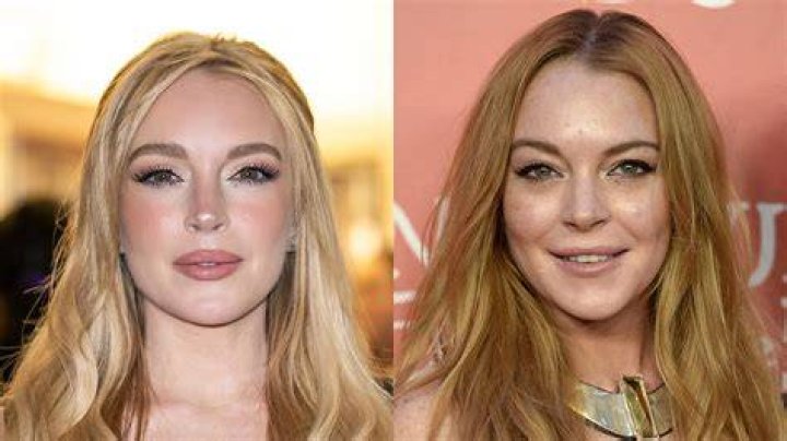 Unveiling The Truth Behind Lindsay Lohan's Plastic Surgery Journey