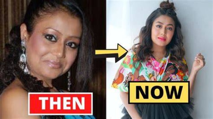 Unveiling The Truth: Neha Kakkar's Plastic Surgery Journey
