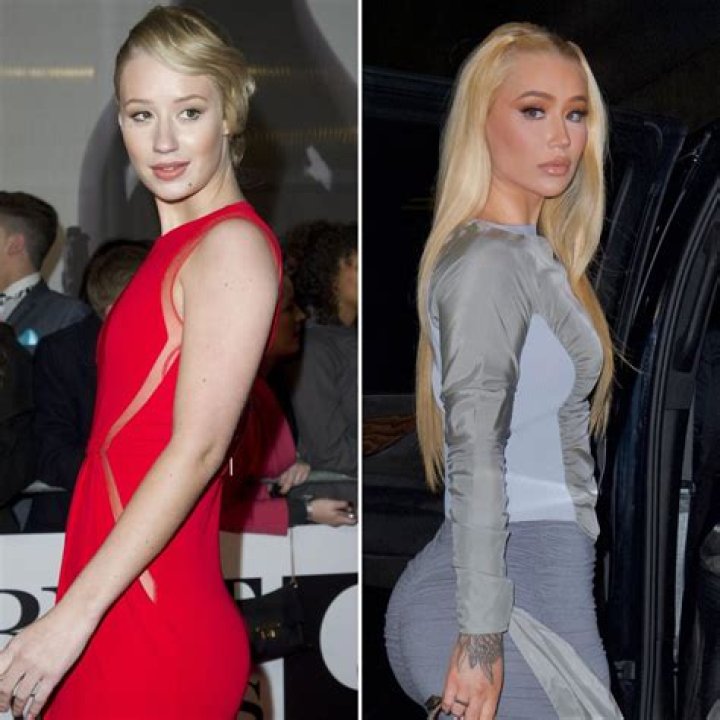 What Happened to Iggy Azalea's Body? Unpacking Her Health and Appearance Journey