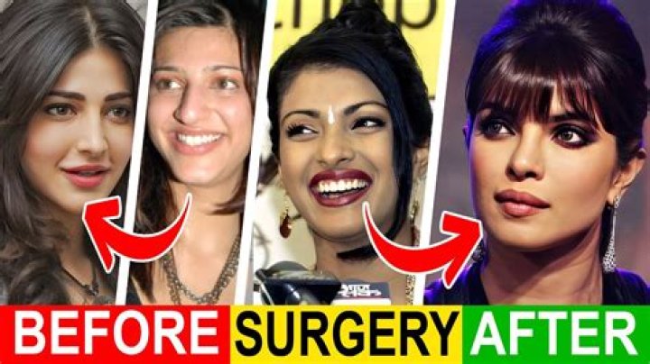 Which Actress Hasn't Done Plastic Surgery?