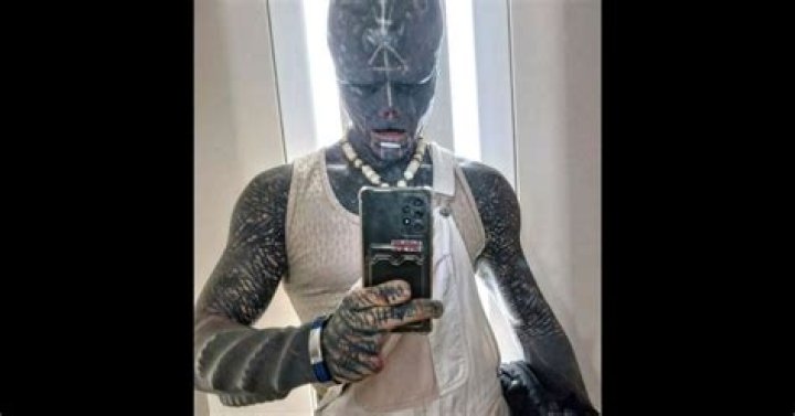 Who is the Black Alien Guy? Exploring the Man Behind the Transformation and Hypothetical Health Considerations