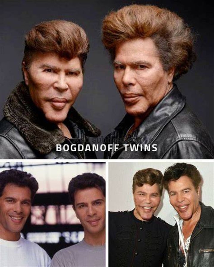 Why Did The Bogdanoff Twins Look So Different?